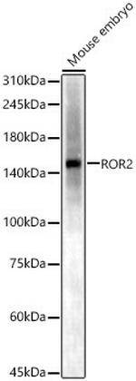 ROR2 Polyclonal Antibody
