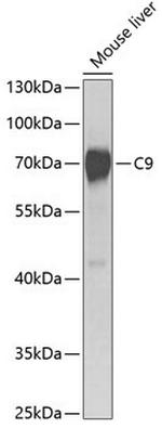 Complement C9 Polyclonal Antibody