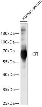 Complement Factor I Polyclonal Antibody