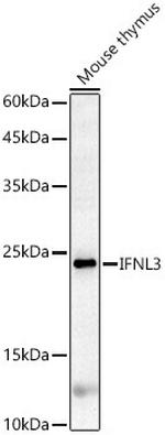 IL-28B Polyclonal Antibody