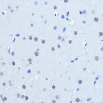 PIAS2 Polyclonal Antibody