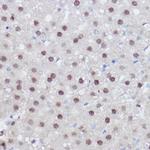 PPAR delta Polyclonal Antibody