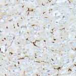 CD10 Antibody in Immunohistochemistry (Paraffin) (IHC (P))