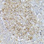 CD10 Antibody in Immunohistochemistry (Paraffin) (IHC (P))