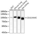 CD10 Antibody in Western Blot (WB)