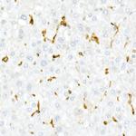 CD74 Antibody in Immunohistochemistry (Paraffin) (IHC (P))