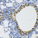 IQGAP1 Antibody in Immunohistochemistry (Paraffin) (IHC (P))