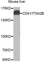 CD41 Antibody in Western Blot (WB)