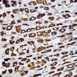 BNIP3 Polyclonal Antibody