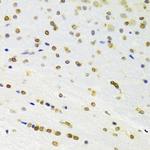 DOK1 Antibody in Immunohistochemistry (Paraffin) (IHC (P))