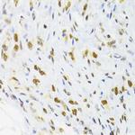 DOK1 Antibody in Immunohistochemistry (Paraffin) (IHC (P))
