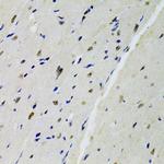 DOK1 Antibody in Immunohistochemistry (Paraffin) (IHC (P))