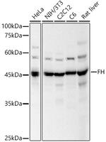 Fumarase Antibody in Western Blot (WB)