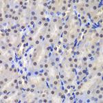GSTP1 Antibody in Immunohistochemistry (Paraffin) (IHC (P))