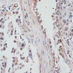 NCOA4 Polyclonal Antibody