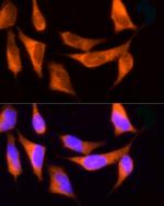 ROCK2 Antibody in Immunocytochemistry (ICC/IF)