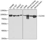 CLC-5 Polyclonal Antibody