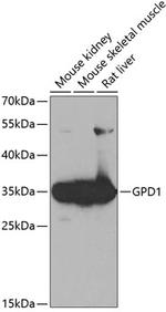 GPD1 Polyclonal Antibody