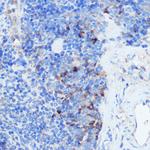 IFNGR1 Polyclonal Antibody
