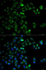 HTRA2 Antibody in Immunocytochemistry (ICC/IF)