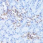 PHAP I Antibody in Immunohistochemistry (Paraffin) (IHC (P))