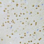 PHAP I Antibody in Immunohistochemistry (Paraffin) (IHC (P))