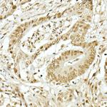 TOPBP1 Antibody in Immunohistochemistry (Paraffin) (IHC (P))