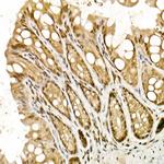 TOPBP1 Antibody in Immunohistochemistry (Paraffin) (IHC (P))
