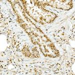 TOPBP1 Antibody in Immunohistochemistry (Paraffin) (IHC (P))