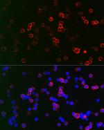 CD22 Antibody in Immunocytochemistry (ICC/IF)