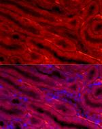 BBOX1 Polyclonal Antibody