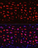 COMP Polyclonal Antibody