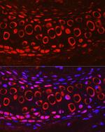 COMP Antibody in Immunohistochemistry (Paraffin) (IHC (P))