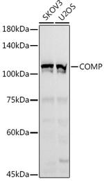 COMP Antibody in Western Blot (WB)