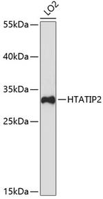 TIP30 Polyclonal Antibody
