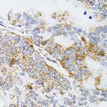 Prodynorphin Polyclonal Antibody