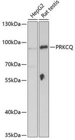 PKC theta Polyclonal Antibody