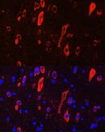 TrkC Antibody in Immunocytochemistry (ICC/IF)