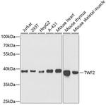 TWF2 Polyclonal Antibody