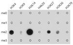 Di-Methyl-Lysine Antibody in Dot Blot (DB)