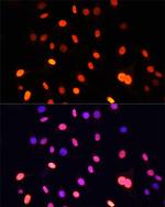 Di-Methyl-Lysine Antibody in Immunocytochemistry (ICC/IF)