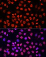 Di-Methyl-Lysine Antibody in Immunocytochemistry (ICC/IF)