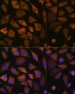 SND1 Polyclonal Antibody