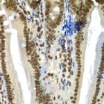 SF3B2 Antibody in Immunohistochemistry (Paraffin) (IHC (P))