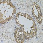 KTN1 Antibody in Immunohistochemistry (Paraffin) (IHC (P))