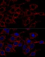 ATP5A1 Antibody in Immunocytochemistry (ICC/IF)