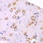 RPS3A Antibody in Immunohistochemistry (Paraffin) (IHC (P))