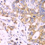 RPS3A Antibody in Immunohistochemistry (Paraffin) (IHC (P))