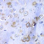 RPS3A Antibody in Immunohistochemistry (Paraffin) (IHC (P))