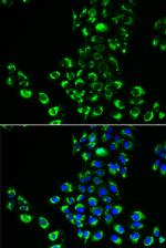 eIF5B Antibody in Immunocytochemistry (ICC/IF)